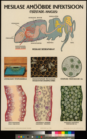 Mesilase amööbide infektsioon (tsüstade-haigus)