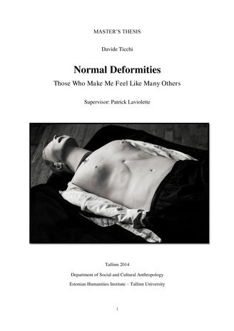 Normal deformities : those who make me feel like many others : master's thesis 